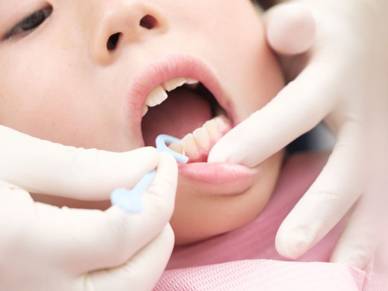 小児歯科とは？